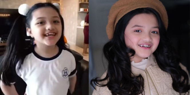 Potret Terbaru Arsy Hermansyah yang Kini Gunakan Kawat Gigi, Terlihat Makin Remaja!