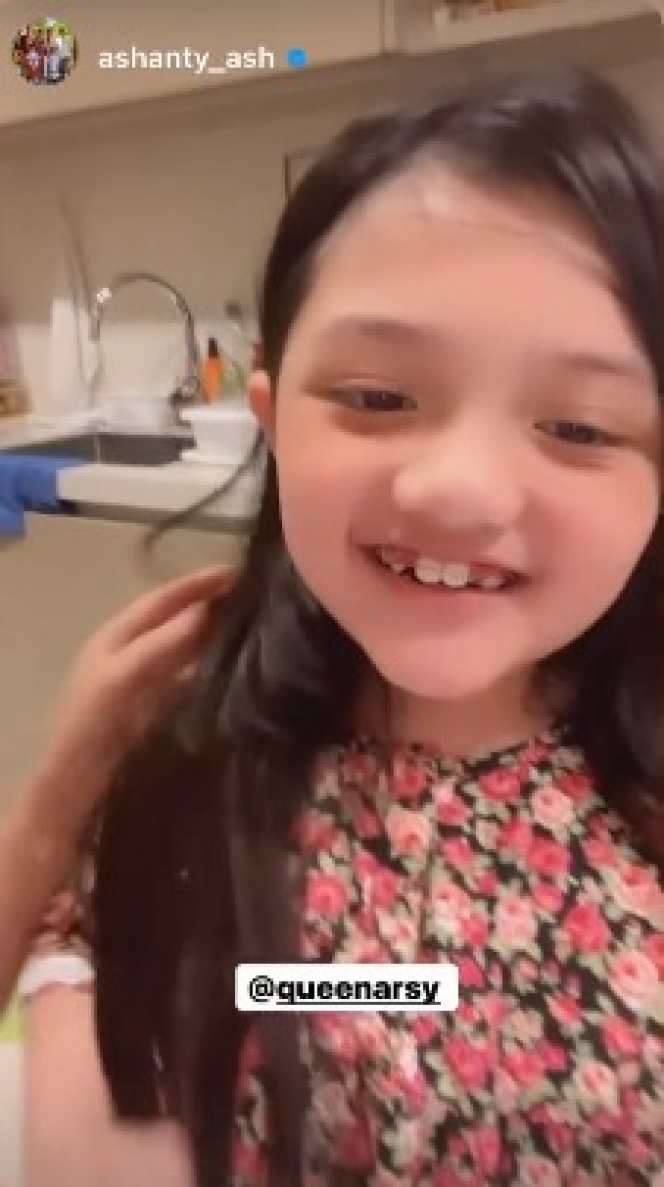 Potret Terbaru Arsy Hermansyah yang Kini Gunakan Kawat Gigi, Terlihat Makin Remaja!