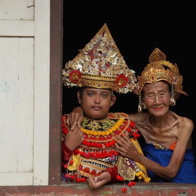 Deretan Potret Ketut Adi Putra, Bocah Asal Bali yang Memiliki Mata Biru Cerah dan Mengagumkan