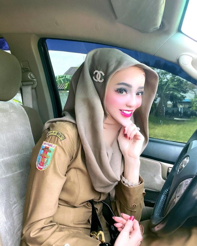 10 Potret Terbaru Yuni Jasmine, PNS Bandar Lampung yang Hidung dan Dagunya Makin Runcing