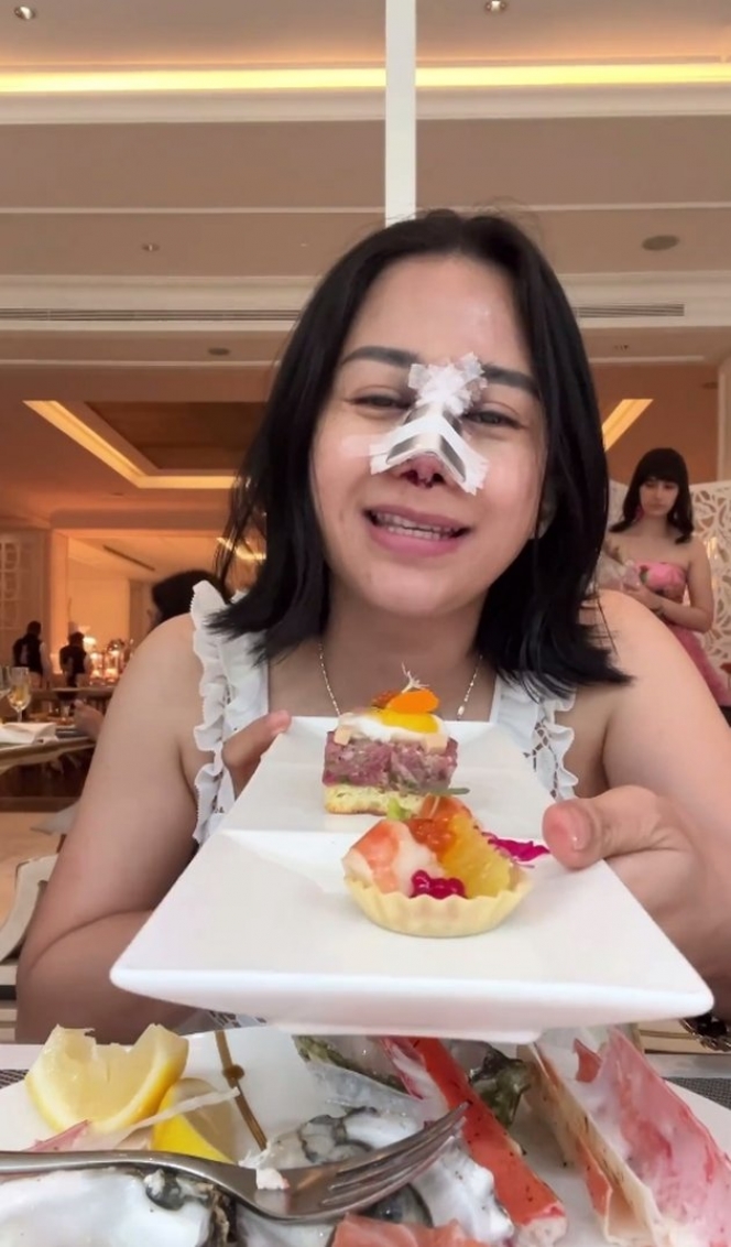 Sempat Disebut Netizen Mirip Suneo, Ini 10 Potret Farida Nurhan Usai Operasi Plastik Hidung Lagi