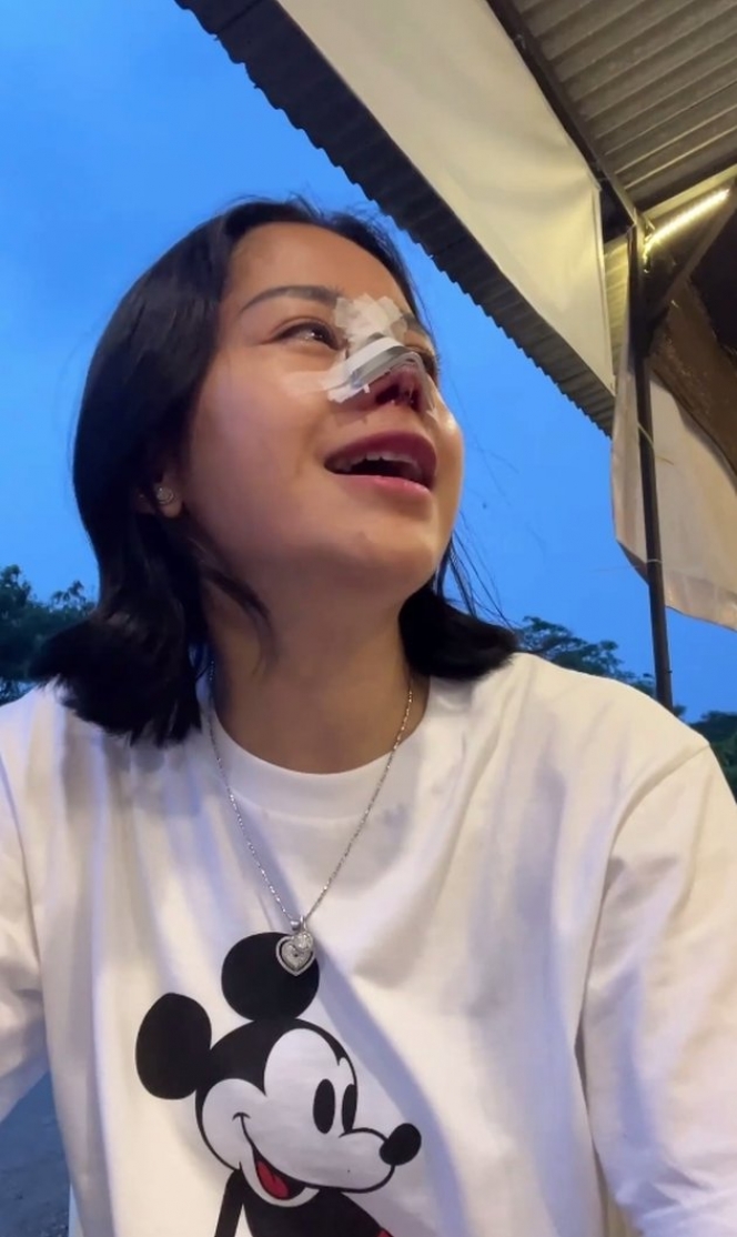 Sempat Disebut Netizen Mirip Suneo, Ini 10 Potret Farida Nurhan Usai Operasi Plastik Hidung Lagi