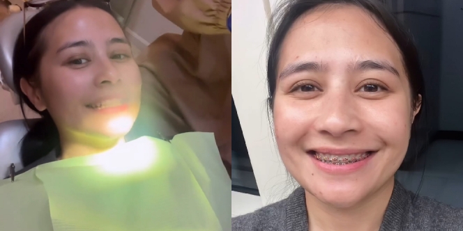 Totalitas, Ini 10 Foto Prilly Latuconsina Pasang Behel Asli Demi Film Barunya