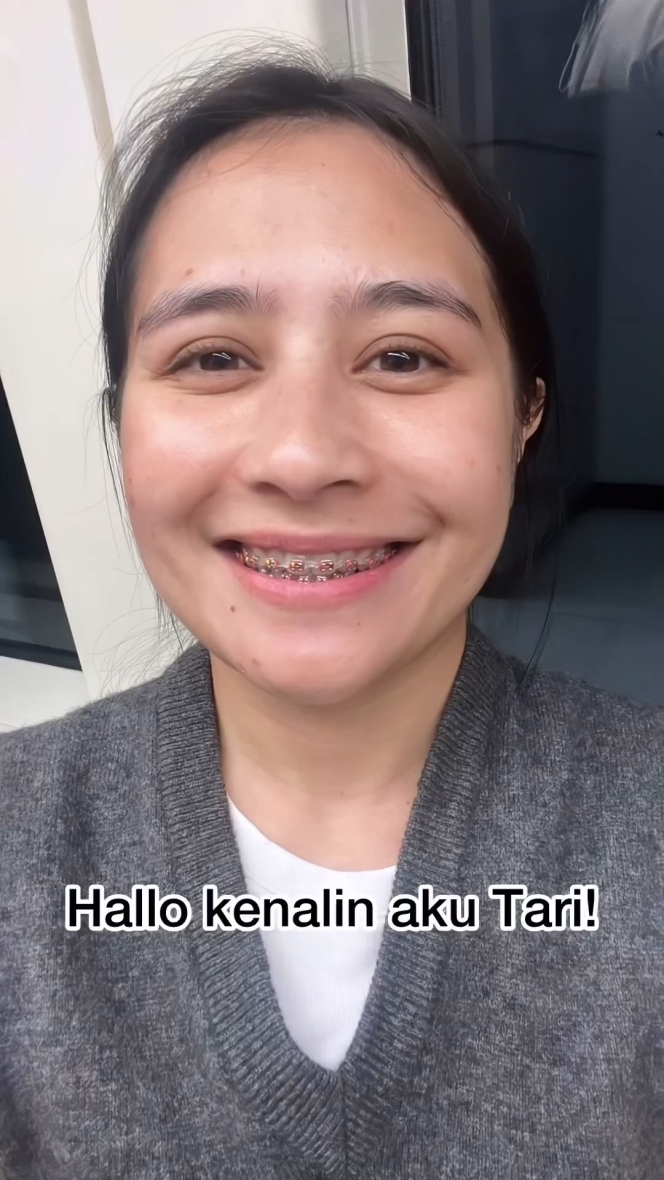 Totalitas, Ini 10 Foto Prilly Latuconsina Pasang Behel Asli Demi Film Barunya