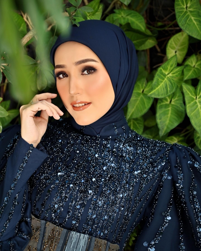 7 Seleb yang Kecurian saat Liburan di Luar Negeri, Terbaru Mobil Ayu Ting Ting Dibobol Maling